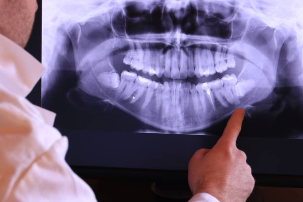 Best Emergency Tooth Extraction in Columbus, IN