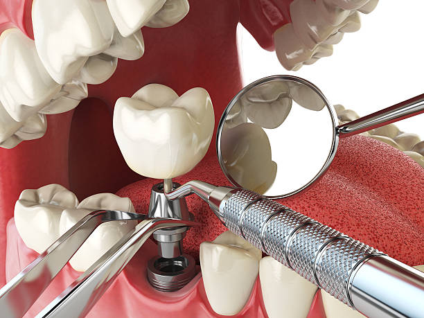 Best After-Hours Dental Trauma Care in Columbus, IN